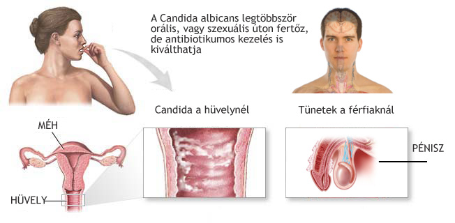 gyógyszerek a Candida gomba kezelésére a testben férgek saury ben