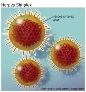 Genitalis Herpes