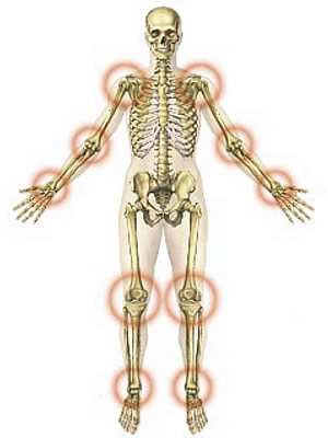csontok és ízületek traumás sérülései hogyan kell kenni az ízületeket a fájdalom miatt