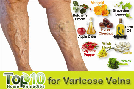 visszér kezelése sóval torna a lábak varikózisának kezelésére