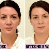 A legtöbb testfunkció és szerv a víztől függ.