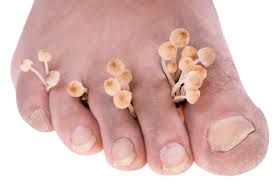 a gangréna foot diabetes mellitus kezelése hidrogén-peroxid