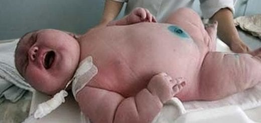 Megdöbbentő! Egy óriás újszülött, - 18 kilós baba született! Megdöbbentő! Egy óriás újszülött, - 18 kilós baba született!