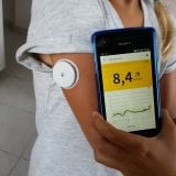 Forradalmi vércukormérő, vércukormonitorozó szenzor, vérminta nélkül