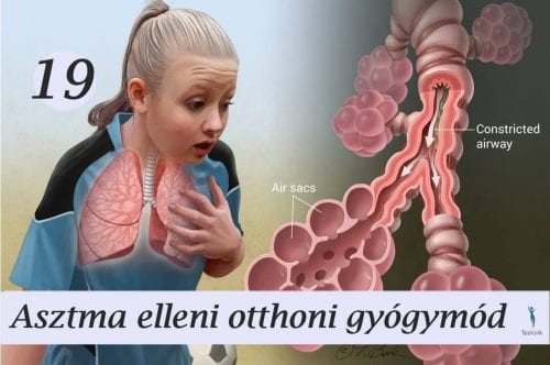 19 asztma elleni otthoni gyogymod