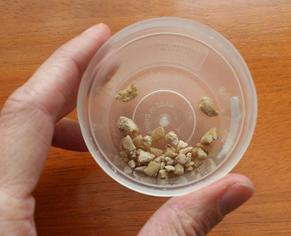 vesekő tünetei veseekő vizsgálat, vesekő típusok